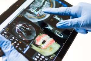 How to Find a Prosthodontist in North Dakota