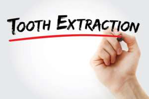When is a tooth extraction recommended?