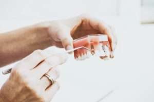 How Do Dental Implants Compare to Natural Teeth?